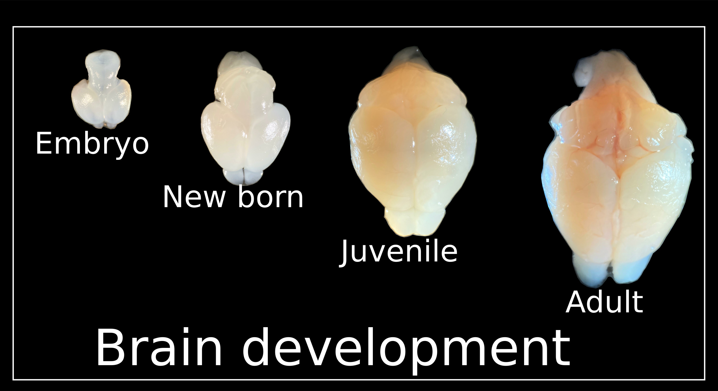 Mouse brain development across timepoints