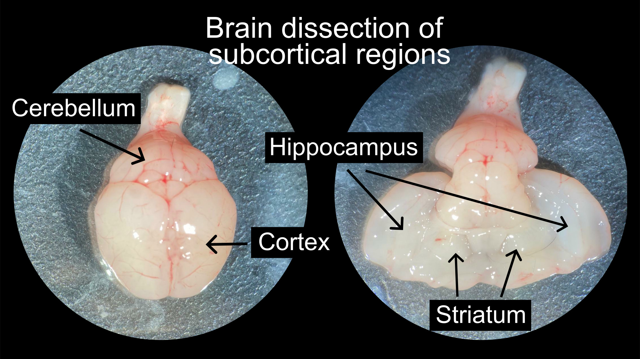 Brain dissection