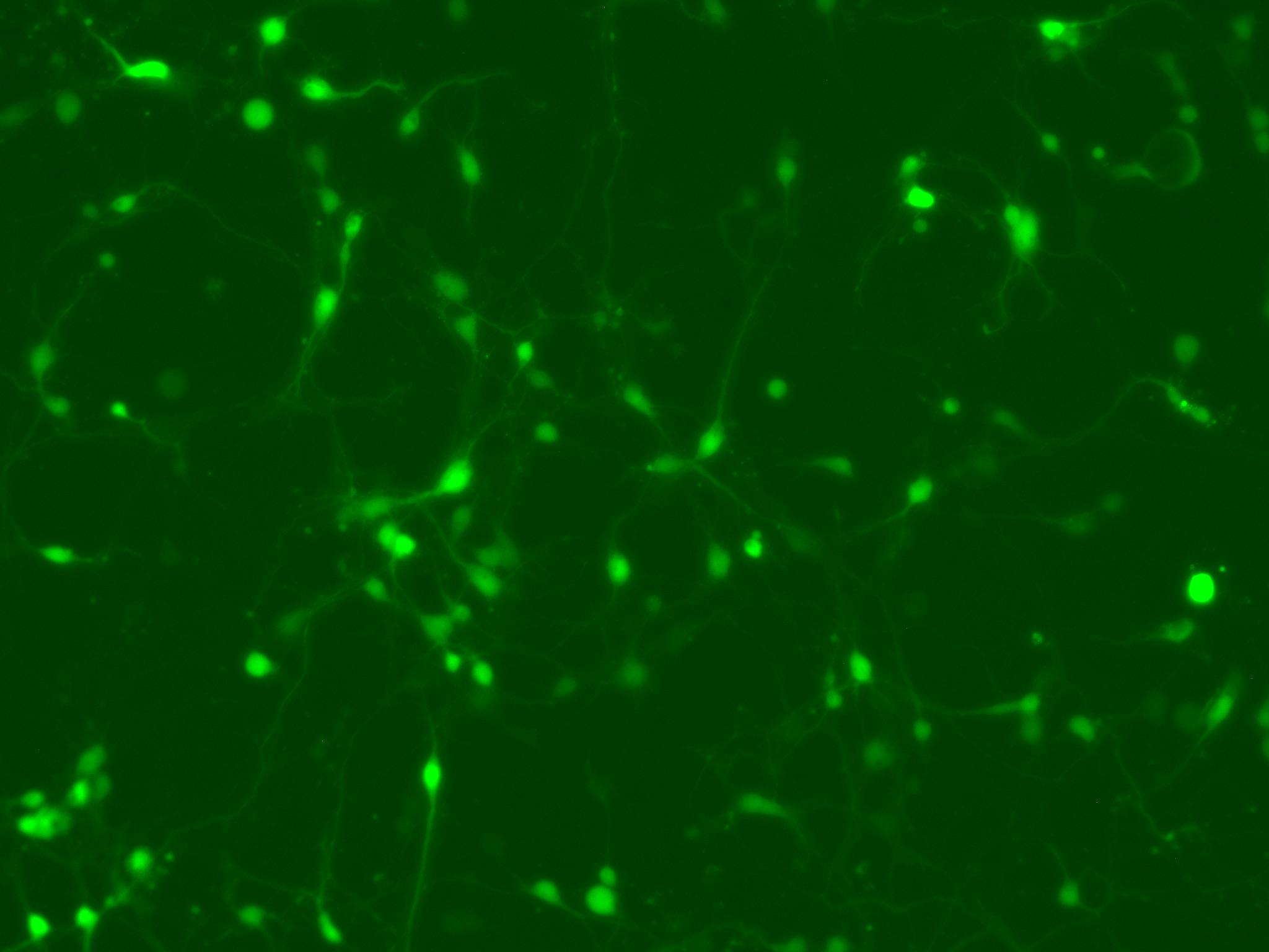 GFP-positive transfected neurons