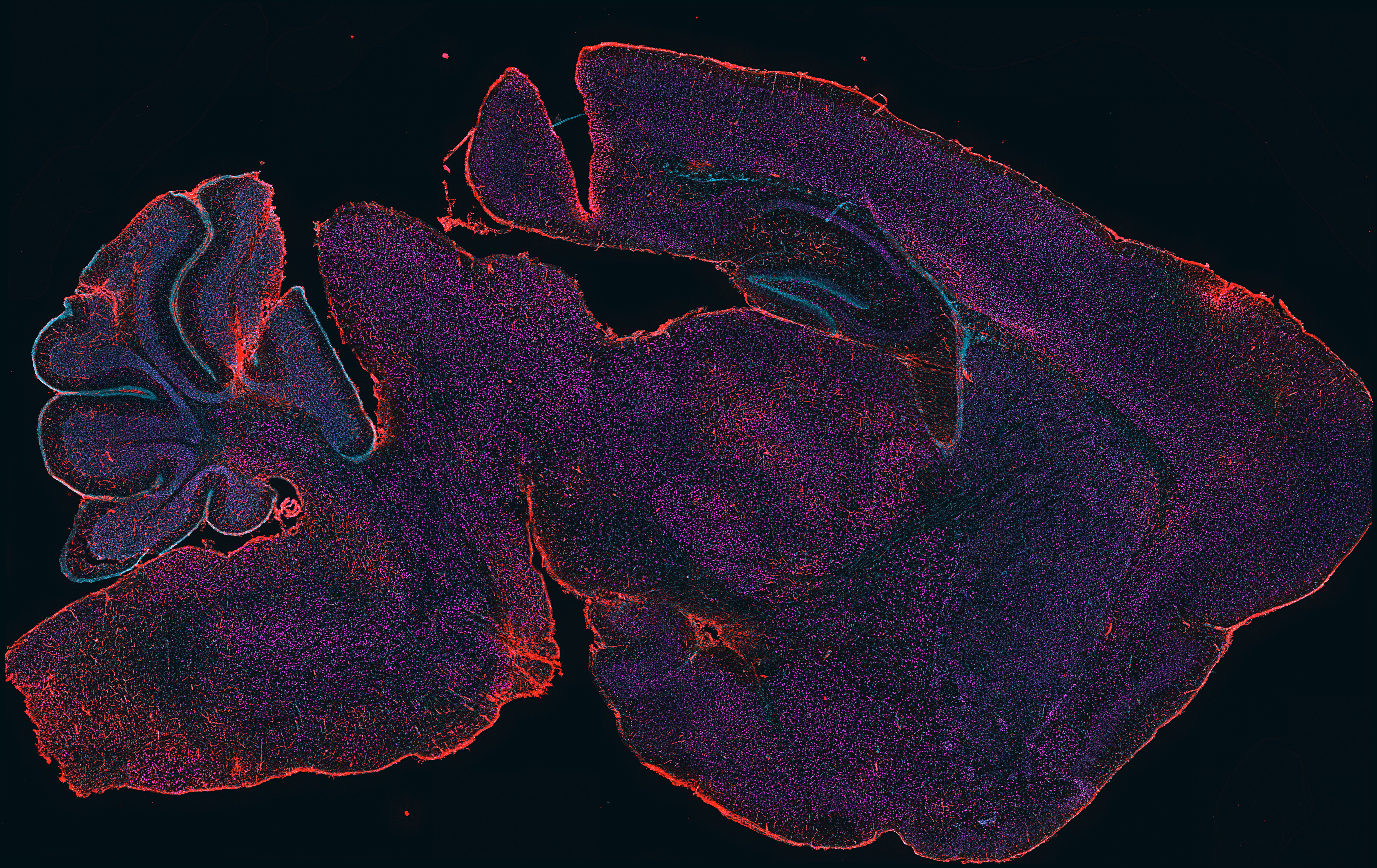 Immunofluorescence - brain slice