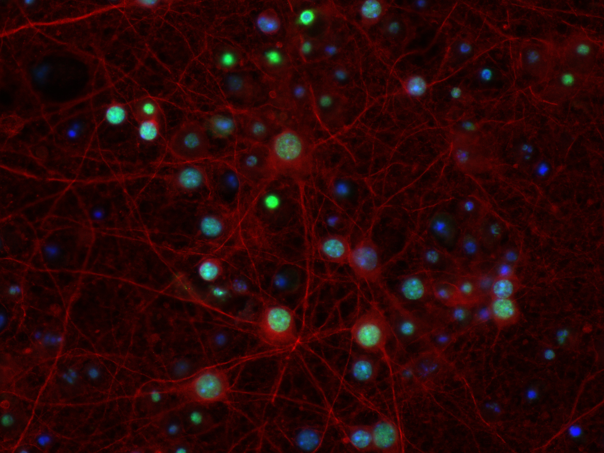 Primary neuron culture